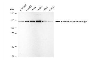 Western blotting analysis using bromodomain containing 4 antibody (ABIN7797800).