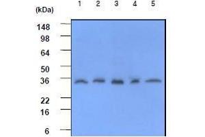 Western Blotting (WB) image for anti-C-Reactive Protein (CRP) (AA 19-224) antibody (ABIN317506) (CRP antibody  (AA 19-224))