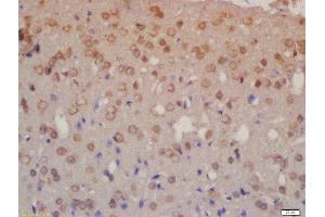 Formalin-fixed and paraffin embedded rat brain labeled with Rabbit Anti-NRG3 Polyclonal Antibody, Unconjugated  at 1:200 followed by conjugation to the secondary antibody and DAB staining (Neuregulin 3 antibody  (AA 351-450))