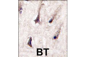 Formalin-fixed and paraffin-embedded human brain tissue reacted with PRKCB polyclonal antibody  , which was peroxidase-conjugated to the secondary antibody, followed by DAB staining . (PKC beta antibody  (C-Term))