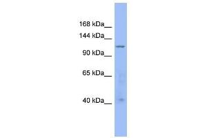 Western Blot showing ARHGAP20 antibody used at a concentration of 1-2 ug/ml to detect its target protein.
