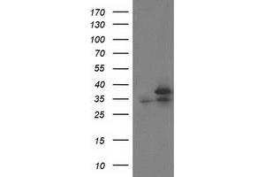 HEK293T cells were transfected with the pCMV6-ENTRY control (Left lane) or pCMV6-ENTRY CDK2 (Right lane) cDNA for 48 hrs and lysed. (CDK2 antibody)