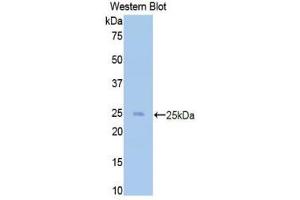 Western Blotting (WB) image for anti-CD40 Ligand (CD40LG) (AA 48-244) antibody (ABIN1858301) (CD40 Ligand antibody  (AA 48-244))