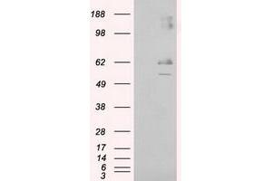 Image no. 5 for anti-Lipase, Endothelial (LIPG) antibody (ABIN1499163)
