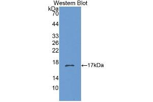 Figure. (CHRNB3 antibody  (AA 119-230))