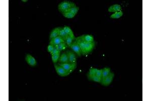 Immunofluorescence staining of HepG2 cells with ABIN7171496 at 1:133, counter-stained with DAPI. (TNKS antibody  (AA 35-130))
