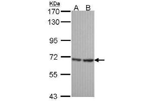 WB Image Sample (30 ug of whole cell lysate) A: Hela B: JurKat 7. (SH3BP1 antibody  (C-Term))
