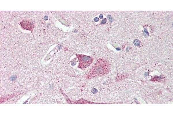 SLC8A3 antibody