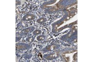 Immunohistochemical staining of human small intestine with CCDC90B polyclonal antibody  shows moderate cytoplasmic positivity at 1:20-1:50 dilution. (CCDC90B antibody)