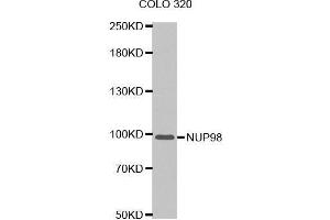 Western blot analysis of extracts of COLO 320 cells tissue, using NUP98 antibody. (NUP98 antibody  (AA 621-920))