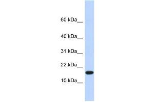 WB Suggested Anti-EGLN2 Antibody Titration:  0. (PHD1 antibody  (N-Term))