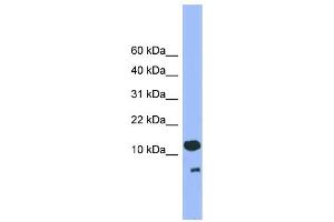 WB Suggested Anti-CDC26 Antibody Titration: 0.
