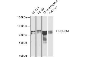 Western blot analysis of extracts of various cell lines, using HNRNPM antibody (ABIN6128031, ABIN6141919, ABIN6141920 and ABIN6222681) at 1:1000 dilution. (HNRNPM antibody  (AA 491-730))