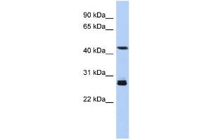 WB Suggested Anti-SYT9 Antibody Titration: 0. (SYT9 antibody  (Middle Region))