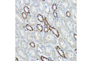 Immunohistochemistry of paraffin-embedded mouse kidney using IP6K1 Rabbit pAb (ABIN6131922, ABIN6142500, ABIN6142501 and ABIN6215821) at dilution of 1:100 (40x lens).