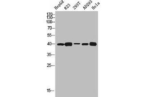 Western blot analysis of HEPG2 823 293T AD293 HELA using SR-1D antibody. (5HT1D antibody  (Internal Region))