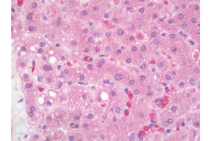Human Liver: Formalin-Fixed, Paraffin-Embedded (FFPE) (IL-25 antibody  (AA 115-132))