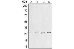 Western blot analysis of Cyclin G1 expression in DLD (A), Jurkat (B), mouse liver (C), rat liver (D) whole cell lysates. (Cyclin G1 antibody  (Center))