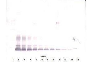 Image no. 3 for anti-PDGF-BB Homodimer antibody (ABIN465590) (PDGF-BB Homodimer antibody)