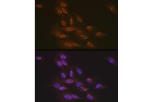 Immunofluorescence analysis of U-2 OS cells using Transportin 3 (Transportin 3 (TNPO3)) Rabbit mAb (ABIN7270971) at dilution of 1:100 (40x lens). (Transportin 3 antibody)
