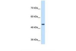 Image no. 2 for anti-Signal Peptide Peptidase-Like 2B (SPPL2B) (AA 93-142) antibody (ABIN6738138) (SPPL2B antibody  (AA 93-142))