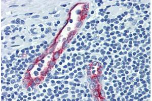 Human Tonsil (formalin-fixed, paraffin-embedded) stained with SELP antibody ABIN462342 followed by biotinylated anti-mouse IgG secondary antibody ABIN481714, alkaline phosphatase-streptavidin and chromogen. (P-Selectin antibody)