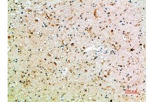 Immunohistochemical analysis of paraffin-embedded human-brain, antibody was diluted at 1:200 (CD16a, CD16b (AA 100-150) antibody)