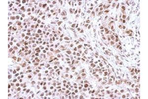 Immunohistochemistry (IHC) image for anti-Checkpoint Kinase 1 (CHEK1) (pSer345) antibody (ABIN2857048)