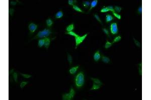 Immunofluorescence staining of HepG2 cells with ABIN7154014 at 1:133, counter-stained with DAPI.