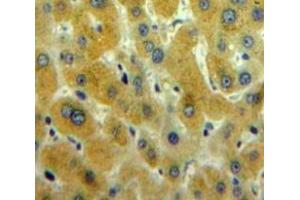 #VALUE! (CAMKII gamma antibody  (AA 75-281))