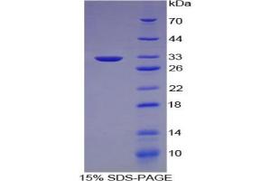 SDS-PAGE analysis of Mouse Lipase, Endothelial Protein. (LIPG Protein)