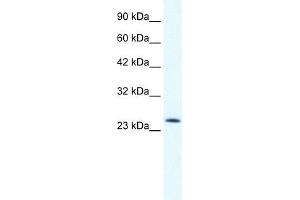 WB Suggested Anti-TCF7 Antibody Titration:  0. (TCF7 antibody  (N-Term))