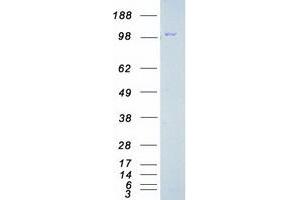 Validation with Western Blot (FAK Protein (Transcript Variant 1) (Myc-DYKDDDDK Tag))