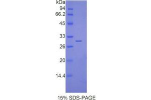 SDS-PAGE analysis of Mouse IL17RD Protein.