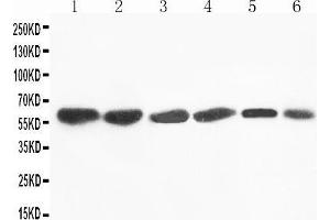 Anti-Flavin containing monooxygenase 4 antibody, Western blotting Lane 1: Rat Liver Tissue Lysate Lane 2: Mouse Liver Tissue Lysate Lane 3: SMMC Cell Lysate Lane 4: HEPA Cell Lysate Lane 5: A431 Cell Lysate Lane 6: MCF-7 Cell Lysate (FMO4 antibody  (N-Term))