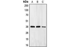 Western blot analysis of EIF2S1 expression in HeLa (A), PC12 (B), A431 (C) whole cell lysates. (EIF2S1 antibody  (Center))