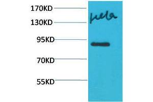 Western Blotting (WB) image for anti-Signal Transducer and Activator of Transcription 4 (STAT4) antibody (ABIN3181592) (STAT4 antibody)