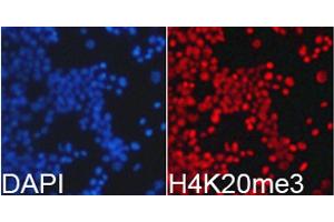 Immunofluorescence analysis of 293T cells using TriMethyl-Histone H4-K20 antibody. (Histone H4 antibody  (3meLys20))