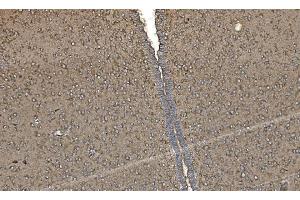 IHC analysis of FABP-1/GOT2 using anti-FABP-1/GOT2 antibody (ABIN7601426). (GOT2 antibody  (AA 35-430))