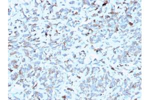 Formalin-fixed, paraffin-embedded human Kidney stained with C1QA Mouse Monoclonal Antibody (C1QA/2952). (C1QA antibody  (AA 104-237))