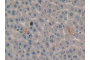 IHC-P analysis of Rat Liver Tissue, with DAB staining. (PLG antibody  (AA 191-433))