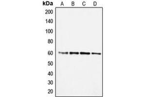 Western blot analysis of SMAD2 expression in A431 (A), Jurkat (B), RAW264. (SMAD2 antibody  (Center))