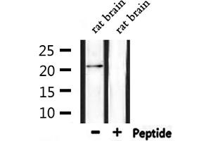 Western blot analysis of extracts from rat brain, using Histone H1 Antibody. (H1FOO antibody  (Internal Region))