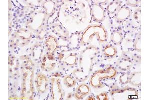 Formalin-fixed and paraffin embedded rat kidney labeled with Rabbit Anti PAI-1 Polyclonal Antibody, Unconjugated (ABIN733223) at 1:200 followed by conjugation to the secondary antibody and DAB staining (PAI1 antibody  (AA 301-402))