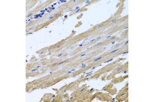 Immunohistochemistry of paraffin-embedded rat heart using NSF antibody. (NSF antibody)