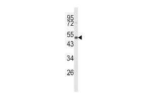 Western blot analysis of CYP24A1 Antibody in mouse spleen tissue lysates (35ug/lane) (CYP24A1 antibody  (C-Term))
