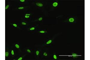 Immunofluorescence of purified MaxPab antibody to XPO5 on HeLa cell. (XPO5 antibody  (AA 1-1204))