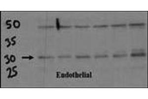 Endothelial cell lysate transferred to membrane was incubated with DSCR1 antibody at a 1:500 dilution. (RCAN1 antibody  (AA 222-252))