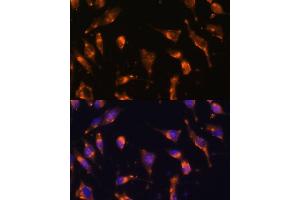 Immunofluorescence analysis of L929 cells using Somatostatin Receptor 2 (SSTR2) Polyclonal Antibody (ABIN7270493) at dilution of 1:100 (40x lens). (SSTR2 antibody  (C-Term))