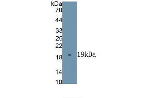 Detection of Recombinant IL1F9, Human using Polyclonal Antibody to Interleukin 1 Family, Member 9 (IL1F9) (IL1F9 antibody  (AA 1-162))